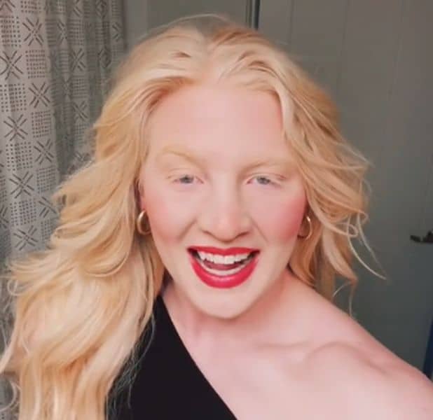 Mya Lynn Lesnar, Brock Lesnar Daughter Age, Albinism, Now